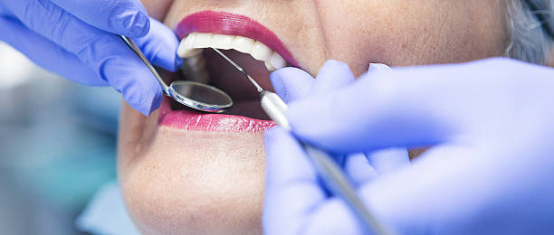 Best Emergency Dental Care for Broken or Chipped Teeth in Lincolnia, VA